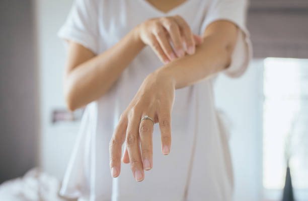 乾癬指甲病變怎麼辦？有什麼要注意？